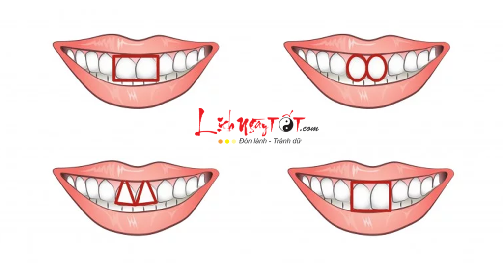 Xem tướng răng cửa tiết lộ bản chất con người thật của bạn