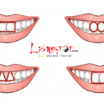 Xem tướng răng cửa tiết lộ bản chất con người thật của bạn