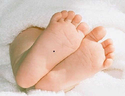 Giải mã ý nghĩa nốt ruồi dưới lòng bàn chân của người giàu sang