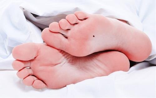 Nốt ruồi ở lòng bàn chân
