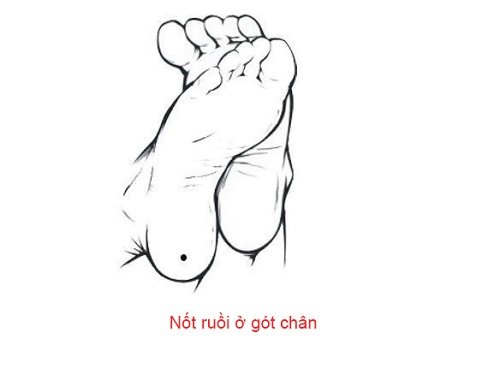 Nốt ruồi ở chân: Giải mã vận mệnh giàu sang hay nghèo khó