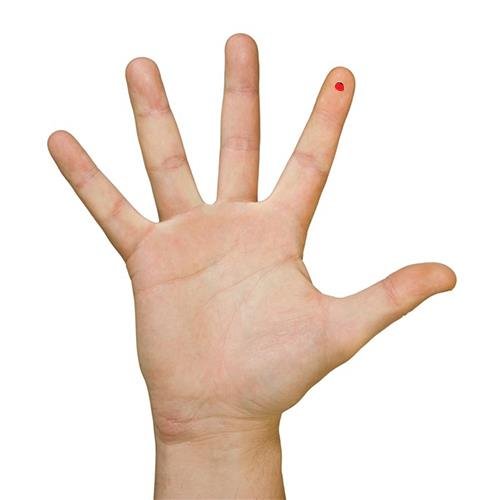 nốt ruồi ở ngón trỏ