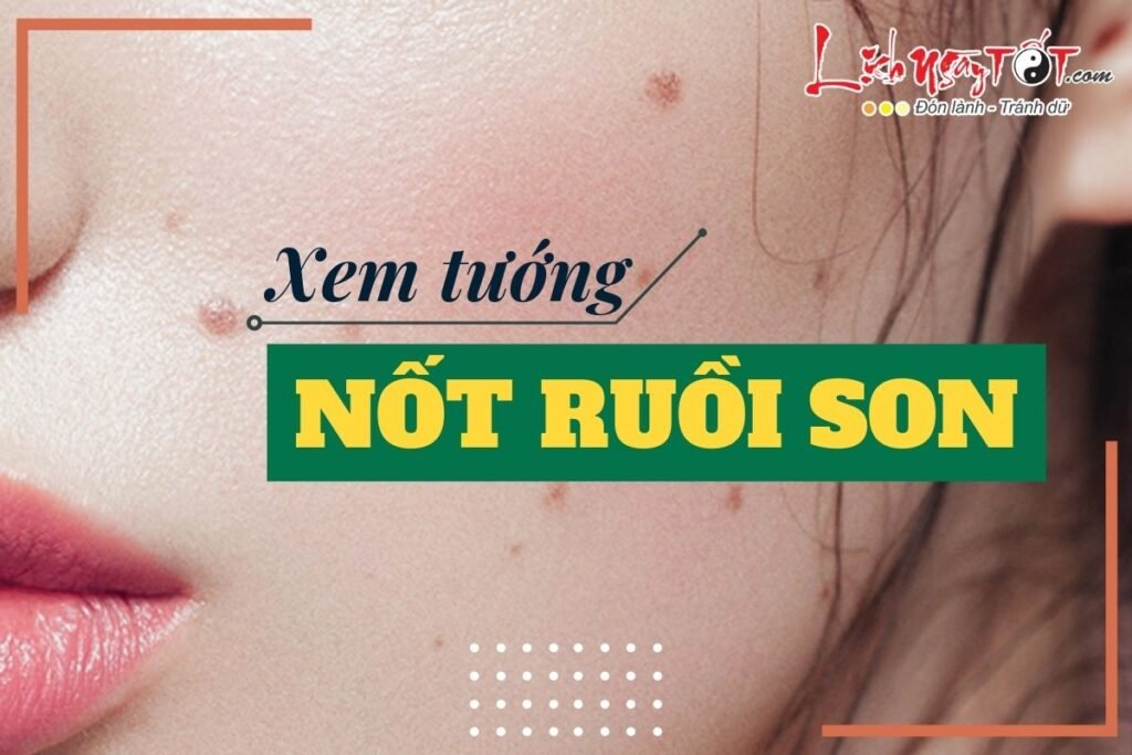 Nốt ruồi son có thực sự mang lại vận may và tài lộc?