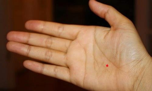 nốt ruồi son trong lòng bàn tay