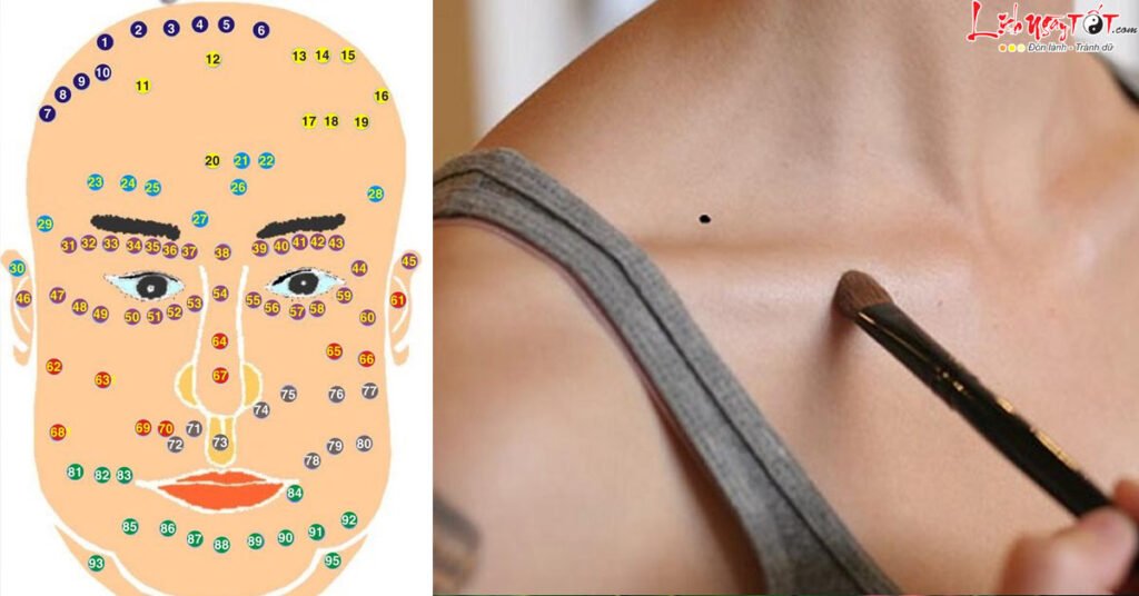 5 vị trí nốt ruồi hiểm độc có thể gây ảnh hưởng xấu cả đời