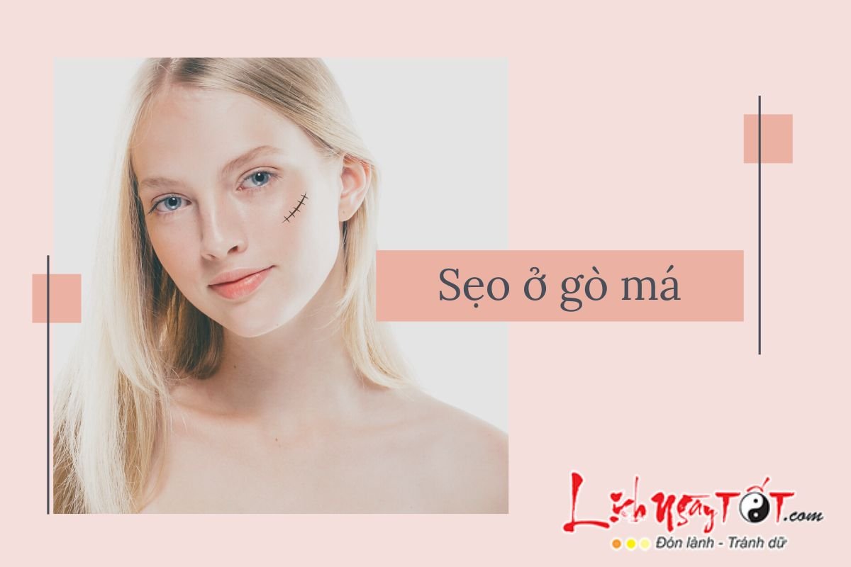 Sẹo và nốt ruồi ở gò má nói lên điều gì