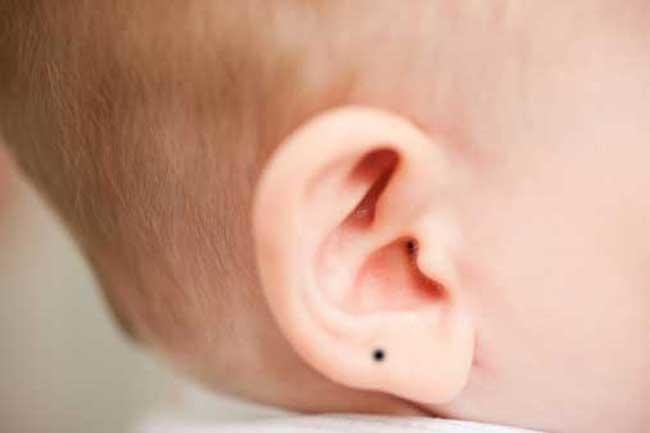 Sở hữu những nốt ruồi may mắn này, cuộc đời ắt sẽ sung túc